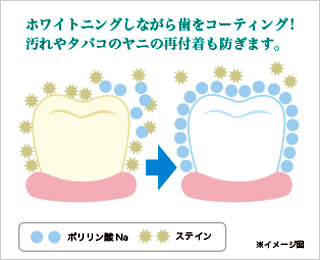オフィスホワイトニング